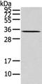Mitochondrial uncoupling protein 2 antibody, CSB-PA299698, Cusabio, Western Blot image 