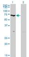 Erythrocyte Membrane Protein Band 4.2 antibody, H00002038-M01, Novus Biologicals, Western Blot image 