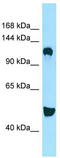 Diacylglycerol Kinase Delta antibody, TA338223, Origene, Western Blot image 