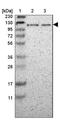 Beta-1,4-N-Acetyl-Galactosaminyltransferase 3 antibody, NBP1-90836, Novus Biologicals, Immunohistochemistry frozen image 