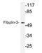 EGF Containing Fibulin Extracellular Matrix Protein 1 antibody, AP21171PU-N, Origene, Western Blot image 