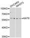 hMOF antibody, MBS128140, MyBioSource, Western Blot image 