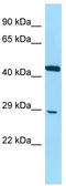 DnaJ Heat Shock Protein Family (Hsp40) Member C8 antibody, TA333871, Origene, Western Blot image 