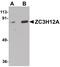 Zinc Finger CCCH-Type Containing 12A antibody, PA5-20926, Invitrogen Antibodies, Western Blot image 