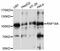 E3 ubiquitin-protein ligase RNF19A antibody, STJ113937, St John