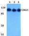Cyclin-dependent kinase-like 5 antibody, A01814, Boster Biological Technology, Western Blot image 