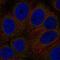 Golgi pH regulator antibody, NBP2-55925, Novus Biologicals, Immunocytochemistry image 