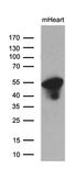 Protein Phosphatase 1 Regulatory Subunit 36 antibody, MA5-27157, Invitrogen Antibodies, Western Blot image 