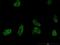Phospholipase C Beta 2 antibody, H00005330-M03, Novus Biologicals, Immunofluorescence image 