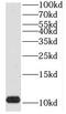 Translocase Of Inner Mitochondrial Membrane 8A antibody, FNab08703, FineTest, Western Blot image 