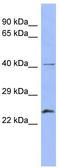 Ras-related protein Rab-5B antibody, TA342184, Origene, Western Blot image 