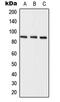 Semaphorin 3E antibody, LS-C353198, Lifespan Biosciences, Western Blot image 