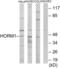 HORMA Domain Containing 1 antibody, LS-C119126, Lifespan Biosciences, Western Blot image 