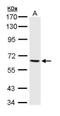 Serine/threonine-protein kinase PAK 1 antibody, PA5-29256, Invitrogen Antibodies, Western Blot image 