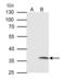 Voltage Dependent Anion Channel 2 antibody, PA5-28106, Invitrogen Antibodies, Immunoprecipitation image 
