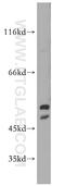 Histidyl-TRNA Synthetase 2, Mitochondrial antibody, 11301-1-AP, Proteintech Group, Western Blot image 