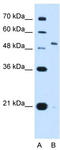 Potassium voltage-gated channel subfamily C member 1 antibody, TA339437, Origene, Western Blot image 