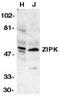 ZIPK antibody, TA305981, Origene, Western Blot image 