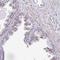 Deltex E3 Ubiquitin Ligase 4 antibody, NBP2-32448, Novus Biologicals, Immunohistochemistry paraffin image 
