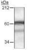 Histone deacetylase 10 antibody, PA1-46293, Invitrogen Antibodies, Western Blot image 