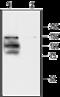Transient Receptor Potential Cation Channel Subfamily V Member 1 antibody, GTX54762, GeneTex, Western Blot image 