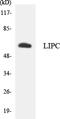 Hepatic lipase antibody, LS-B14677, Lifespan Biosciences, Western Blot image 