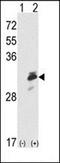 EGFR antibody, orb304743, Biorbyt, Western Blot image 