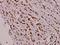 Serine/Threonine Kinase 11 antibody, A00217-1, Boster Biological Technology, Immunohistochemistry paraffin image 