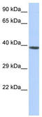 Homeobox protein Hox-A2 antibody, TA343633, Origene, Western Blot image 