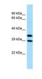 Aldo-Keto Reductase Family 1 Member A1 antibody, orb331283, Biorbyt, Western Blot image 