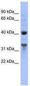 Mitochondrial Ribosomal Protein L37 antibody, TA345017, Origene, Western Blot image 