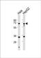 Nei Like DNA Glycosylase 3 antibody, PA5-72424, Invitrogen Antibodies, Western Blot image 