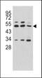 Carboxypeptidase A4 antibody, GTX81517, GeneTex, Western Blot image 