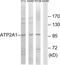 ATPase Sarcoplasmic/Endoplasmic Reticulum Ca2+ Transporting 1 antibody, TA313486, Origene, Western Blot image 