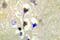Protein Kinase D1 antibody, PA5-36890, Invitrogen Antibodies, Immunohistochemistry paraffin image 