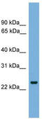 FEV Transcription Factor, ETS Family Member antibody, TA344554, Origene, Western Blot image 