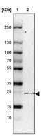 Nucleoside-Triphosphatase, Cancer-Related antibody, NBP1-88331, Novus Biologicals, Western Blot image 