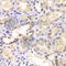 Proteasome 26S Subunit, ATPase 6 antibody, A5377, ABclonal Technology, Immunohistochemistry paraffin image 