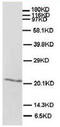 Sonic hedgehog protein antibody, AP23351PU-N, Origene, Western Blot image 