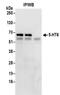 5-Hydroxytryptamine Receptor 6 antibody, NBP2-32079, Novus Biologicals, Immunoprecipitation image 