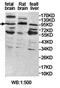 Endothelin-converting enzyme 2 antibody, orb78248, Biorbyt, Western Blot image 