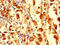 Phosphatidate cytidylyltransferase 1 antibody, LS-C677471, Lifespan Biosciences, Immunohistochemistry paraffin image 