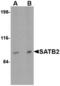 SATB Homeobox 2 antibody, TA306586, Origene, Western Blot image 