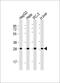 Proteasome Subunit Alpha 5 antibody, M07499-1, Boster Biological Technology, Western Blot image 