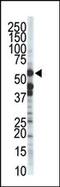 Zinc Metallopeptidase STE24 antibody, 61-386, ProSci, Western Blot image 