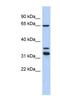 S100P Binding Protein antibody, NBP1-56954, Novus Biologicals, Western Blot image 
