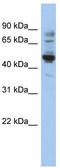 Preferentially Expressed Antigen In Melanoma antibody, TA333925, Origene, Western Blot image 