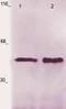 Lymphocyte-specific protein 1 antibody, TA354677, Origene, Western Blot image 