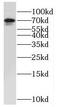 NUAK Family Kinase 2 antibody, FNab05886, FineTest, Western Blot image 