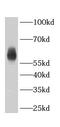 Abhydrolase Domain Containing 18 antibody, FNab01116, FineTest, Western Blot image 